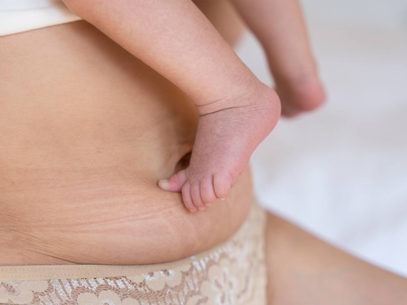 Plastic surgery Royal | Mommy Makeover