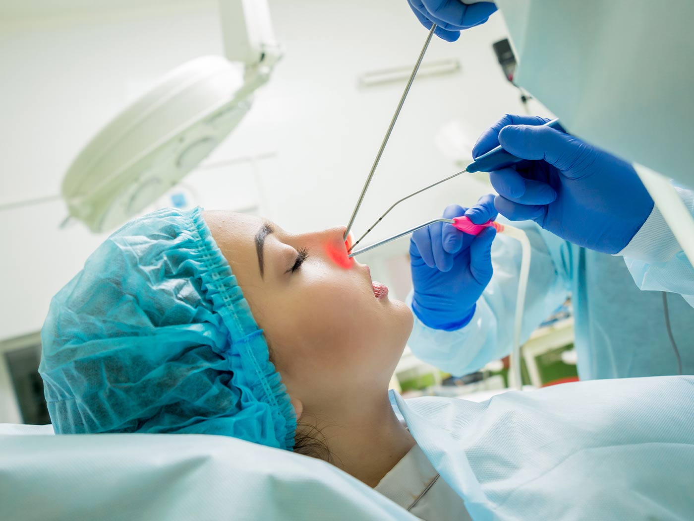 Plastic surgery Royal | Endoscopic Sinus Surgery (FESS)