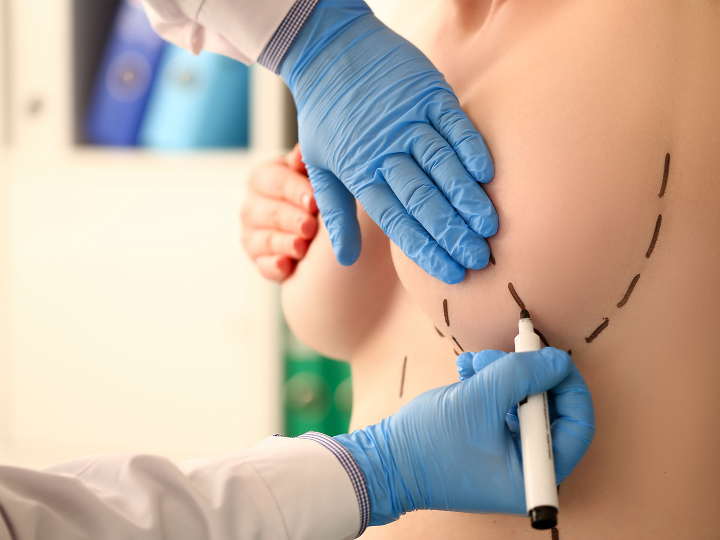 Plastic surgery Royal | Silicone breast implants