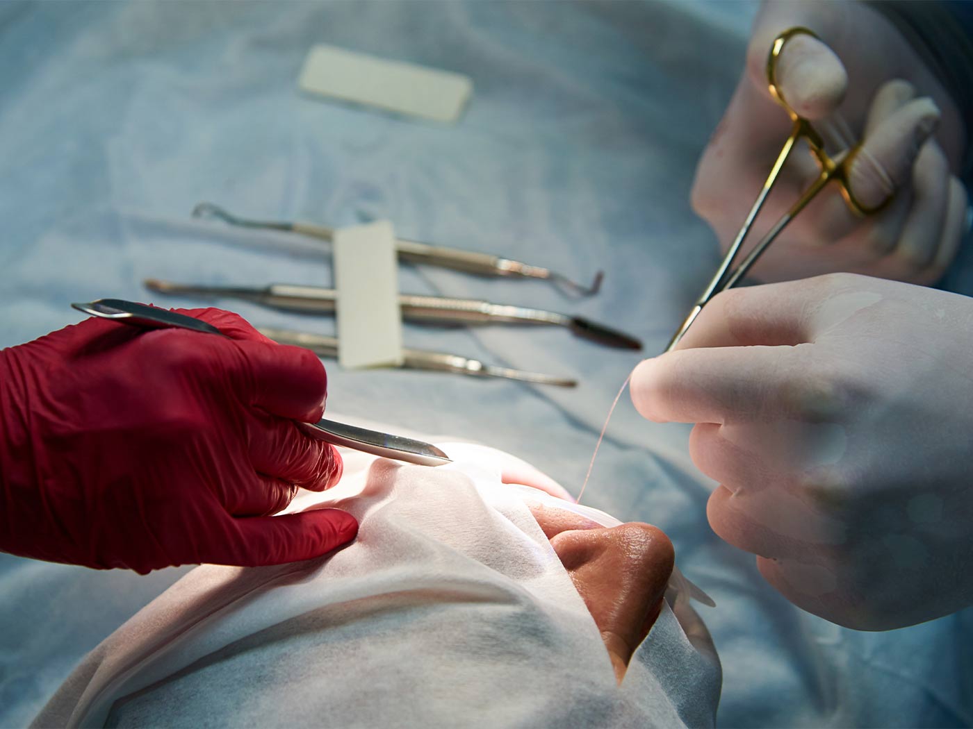 Plastic surgery Royal | Sinus surgery
