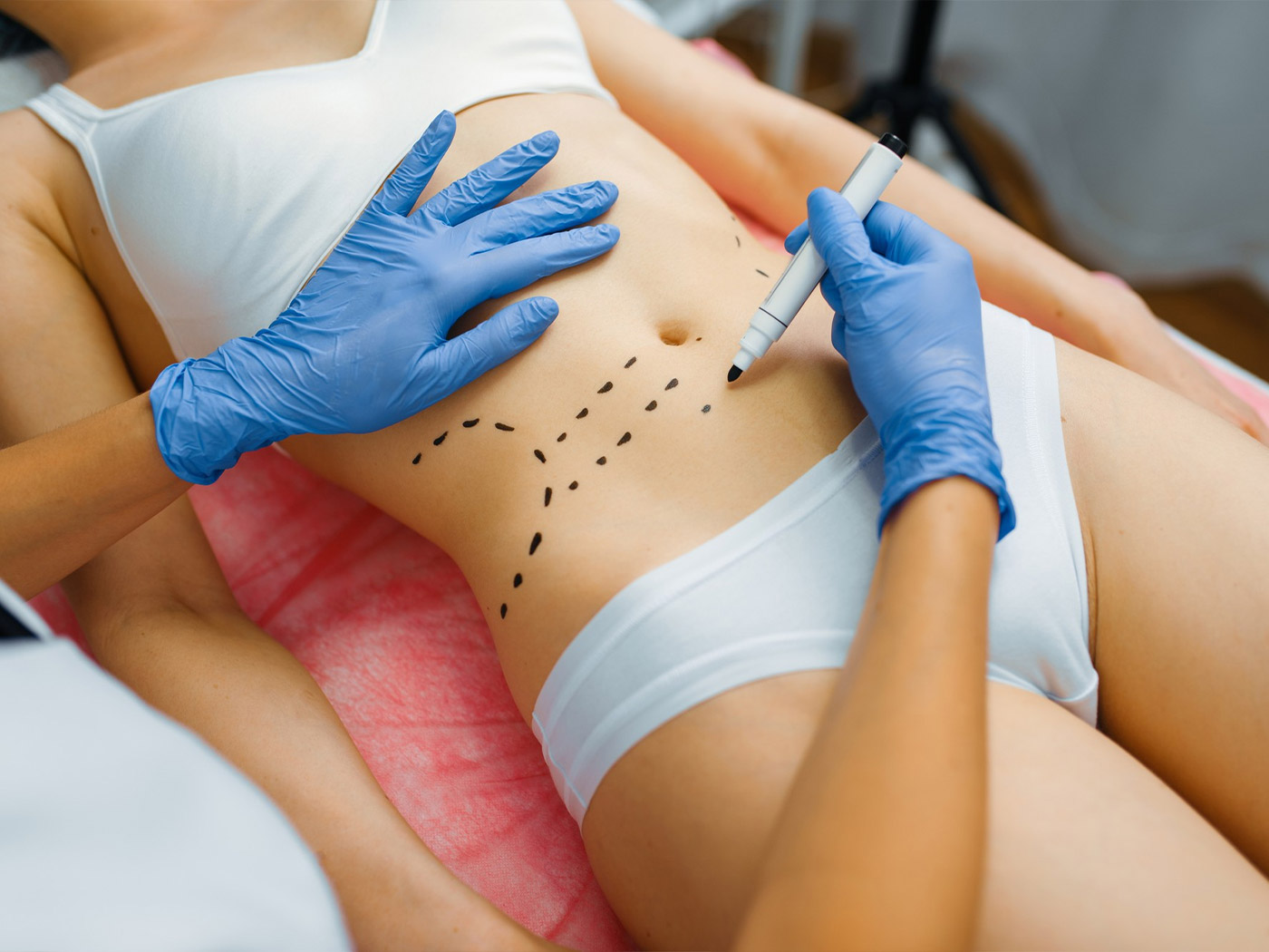 Plastic surgery Royal | What is liposuction and how does it work?