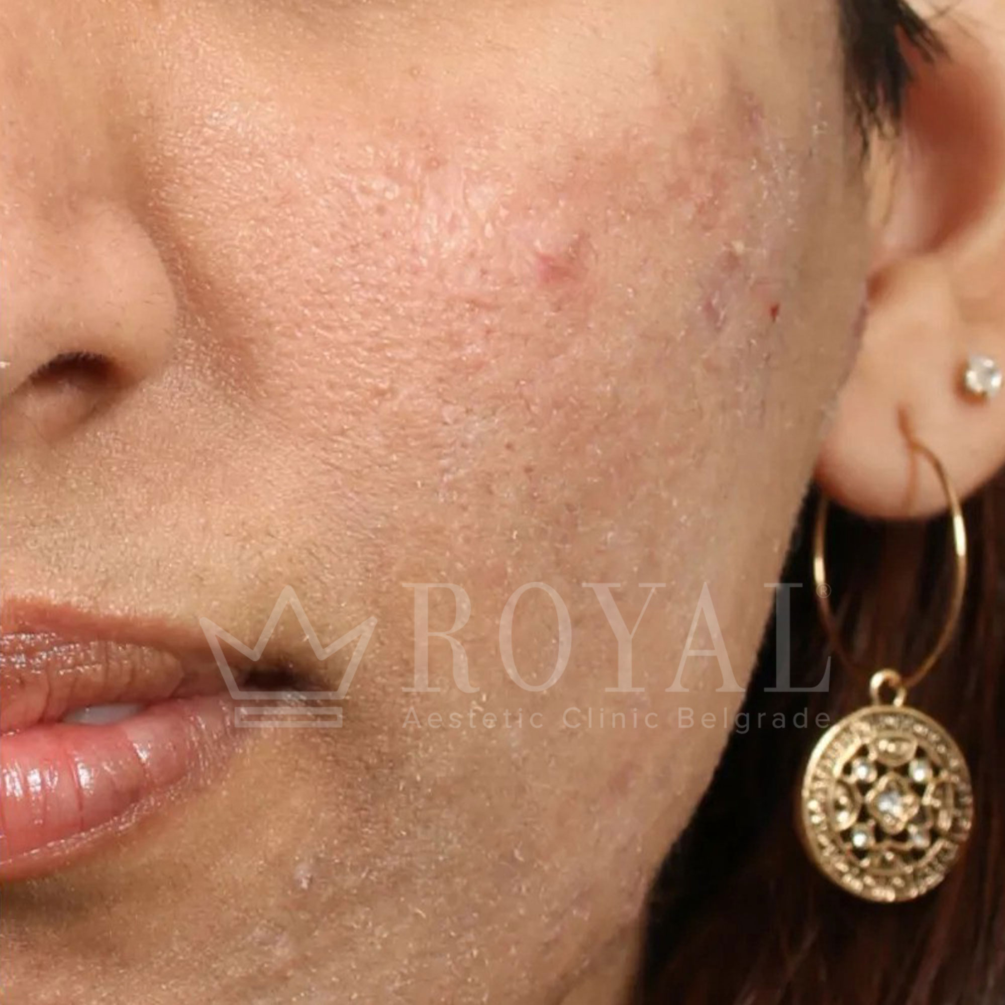 Plastic surgery Royal | Before and after