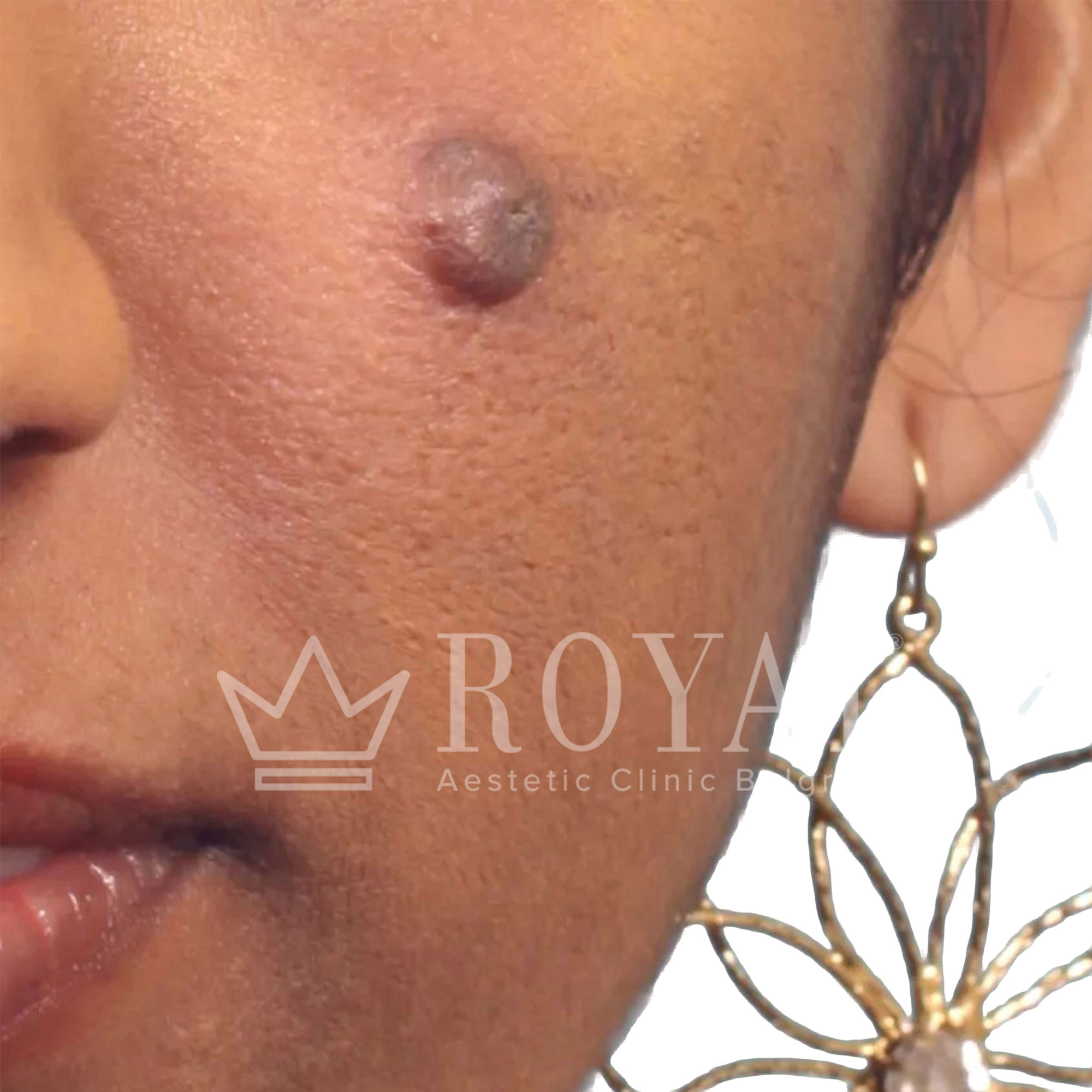 Plastic surgery Royal | Before and after