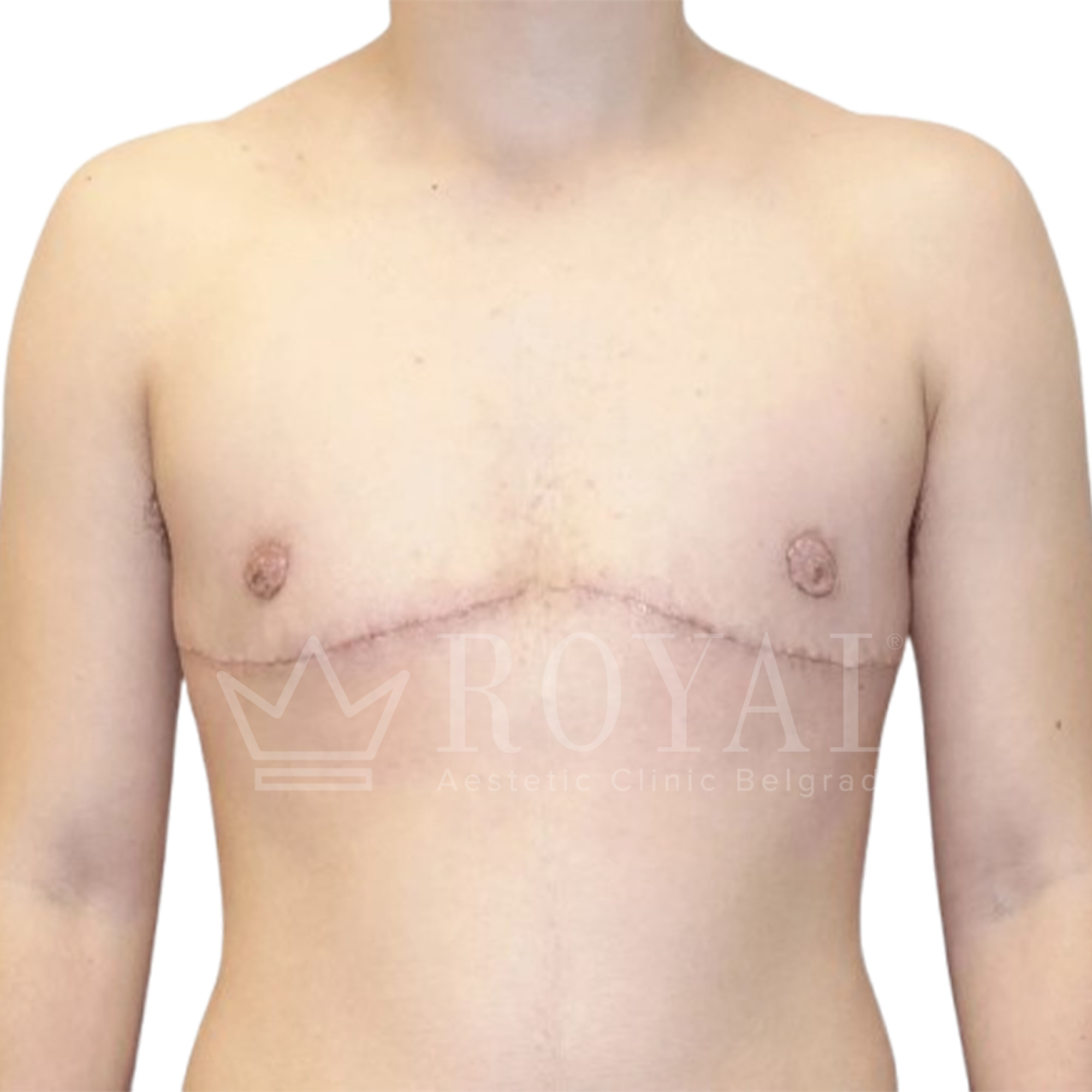 Plastic surgery Royal | Before and after
