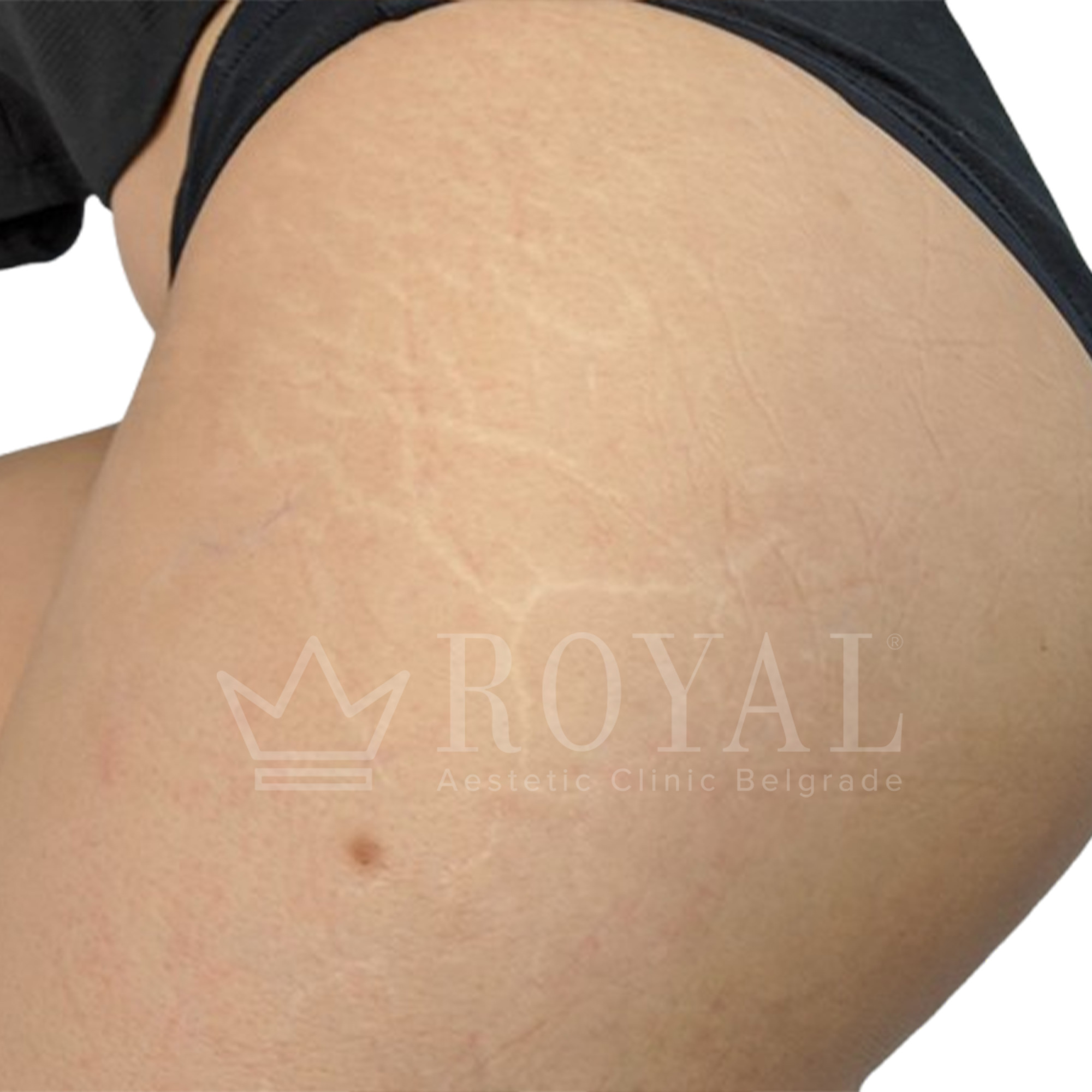 Plastic surgery Royal | Before and after