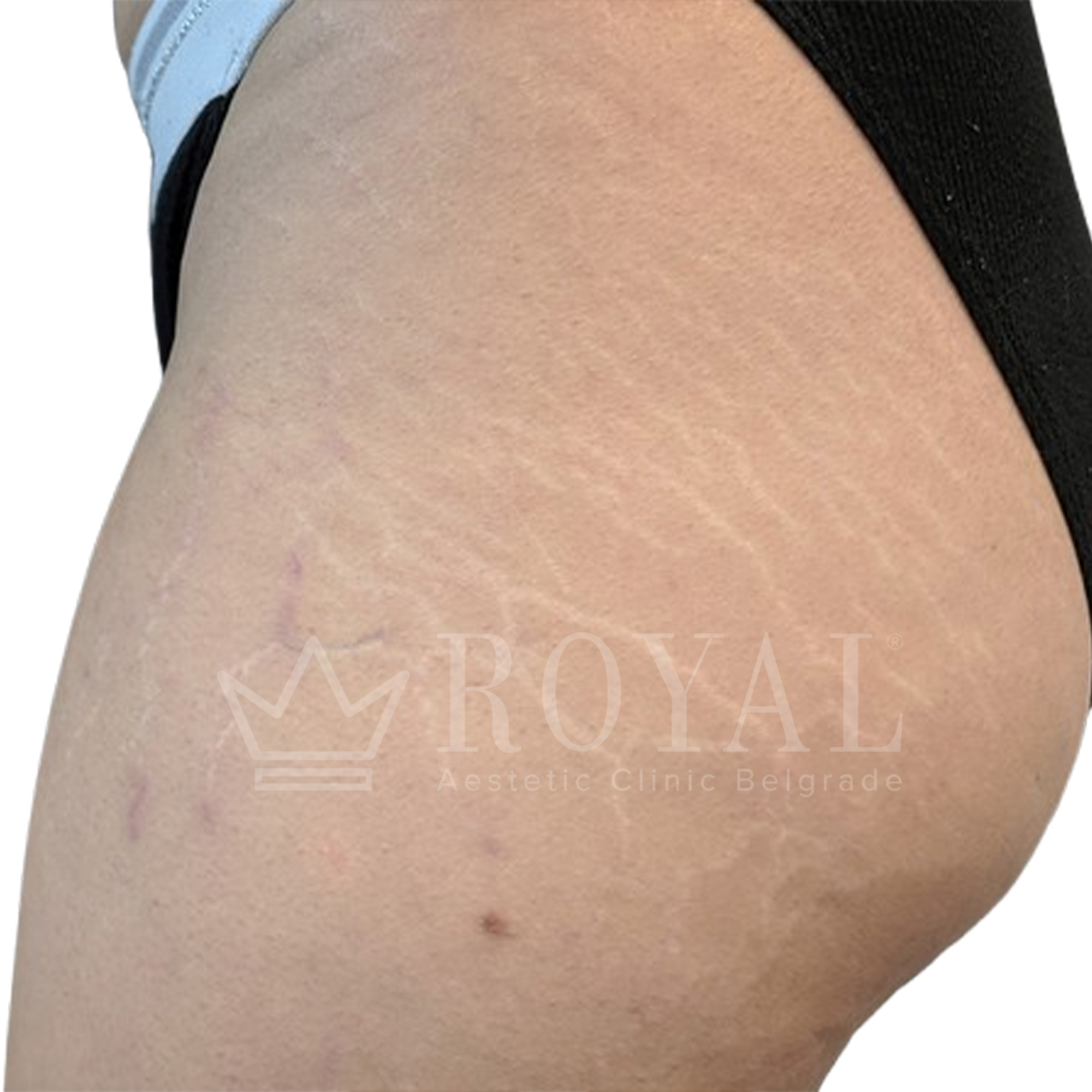 Plastic surgery Royal | Before and after