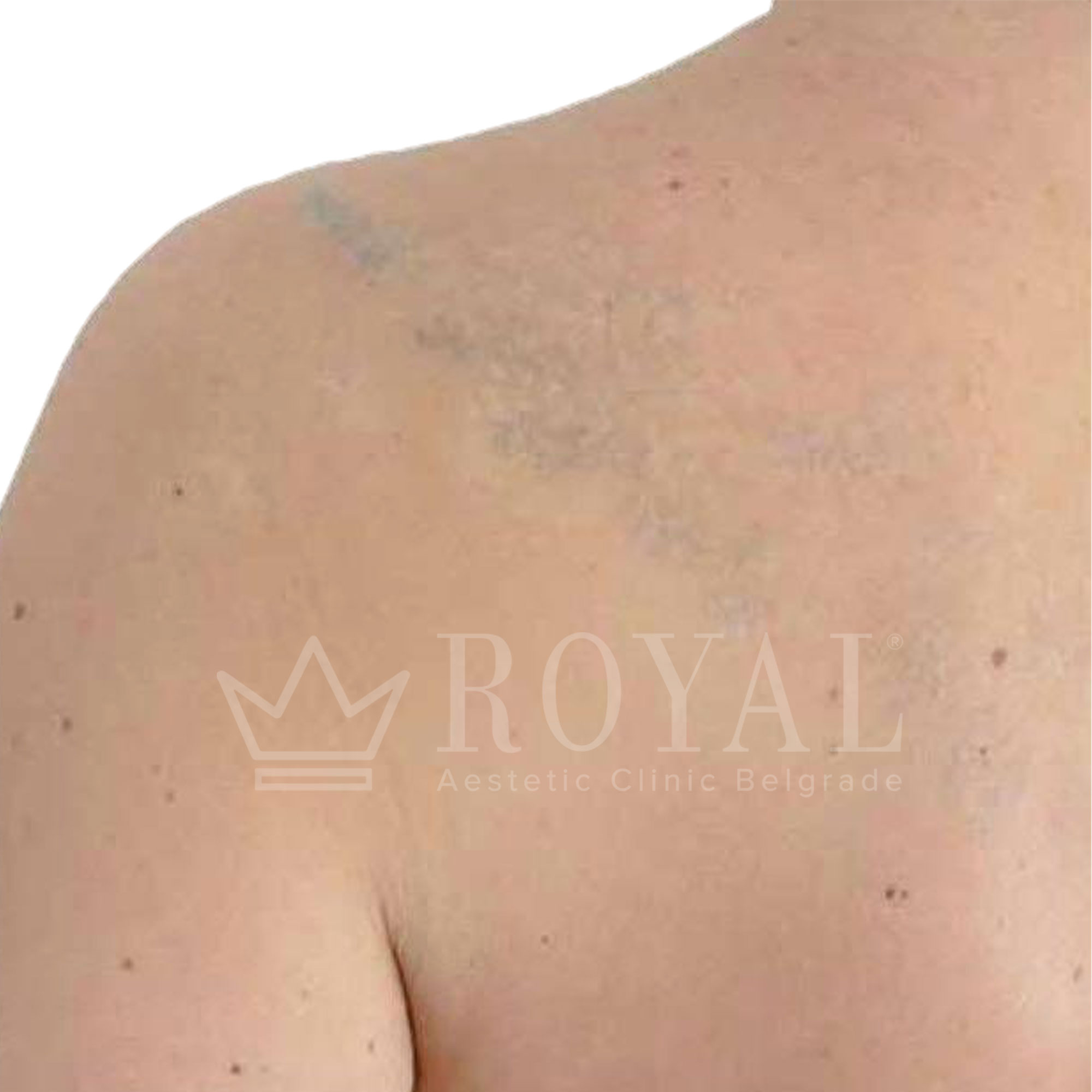 Plastic surgery Royal | Before and after