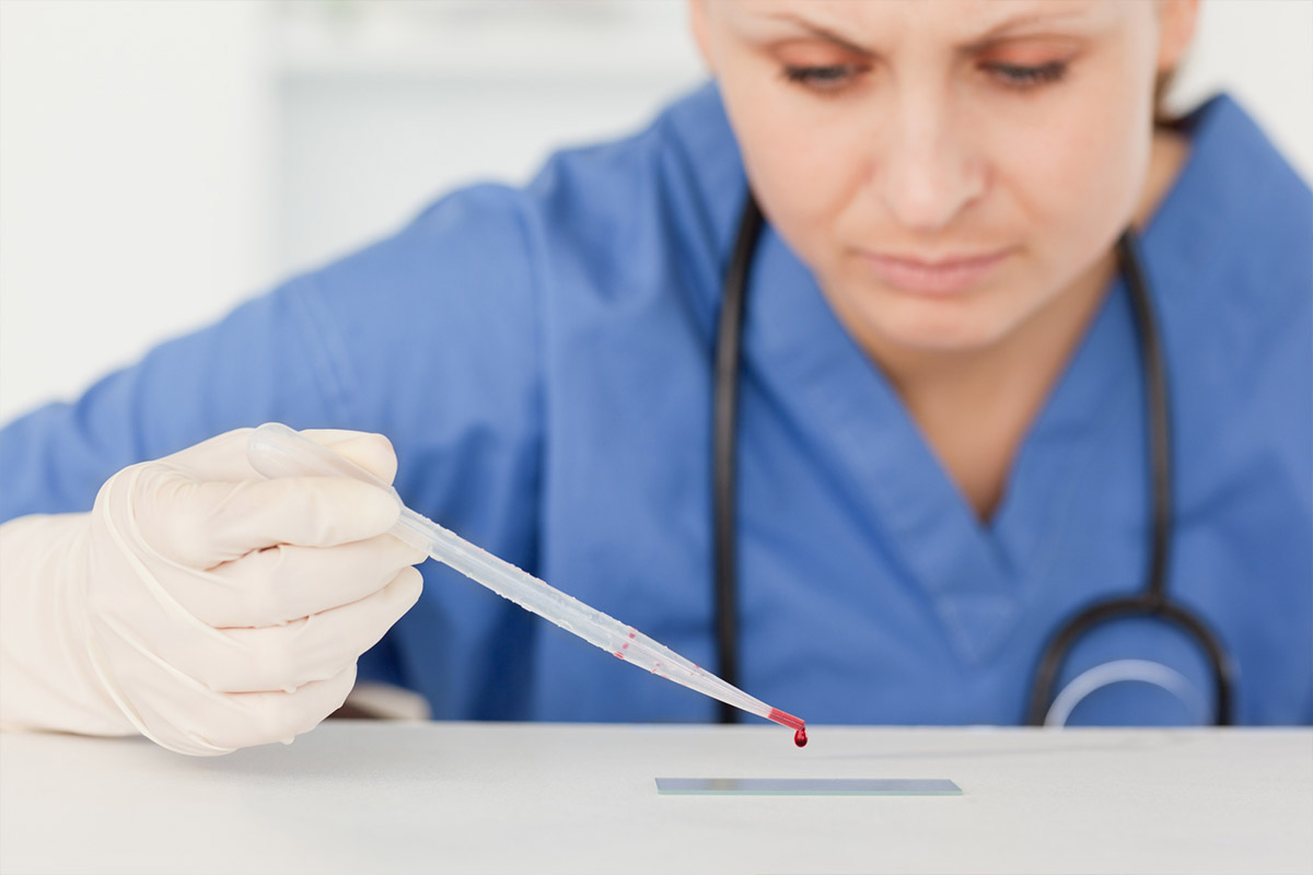 Estetska kirurgija Royal | Biopsija s histopatologijo