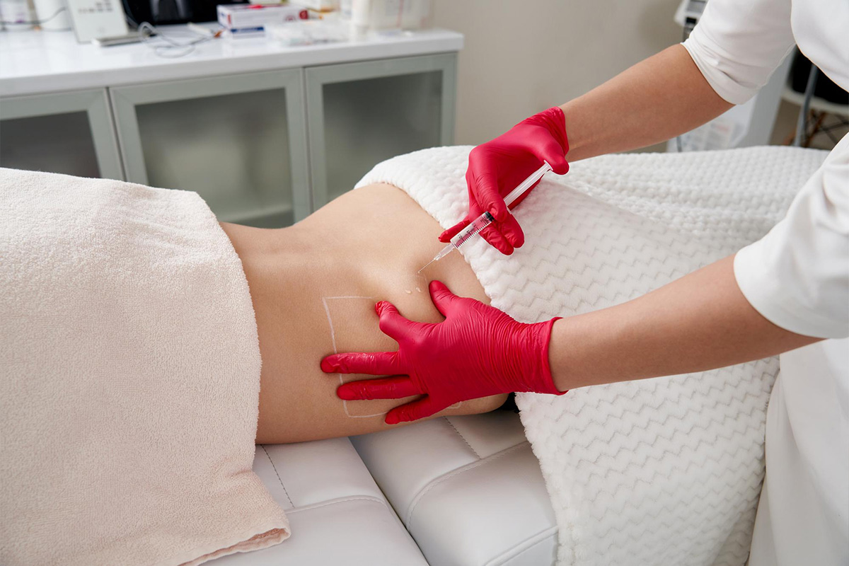 Liposukcija hrbta | Liposukcija hrbta