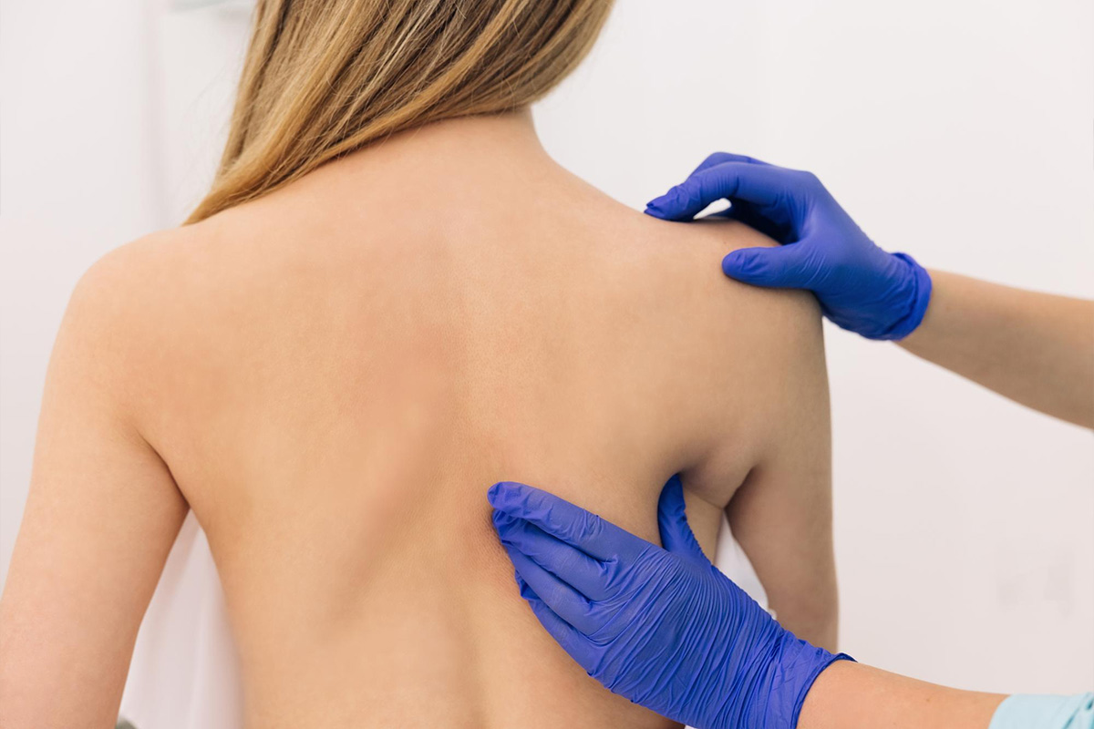 Liposukcija zgornjega dela hrbta | Liposukcija zgornjega dela hrbta