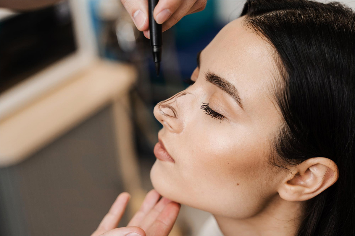 Nosna rinoplastika | Nosna rinoplastika