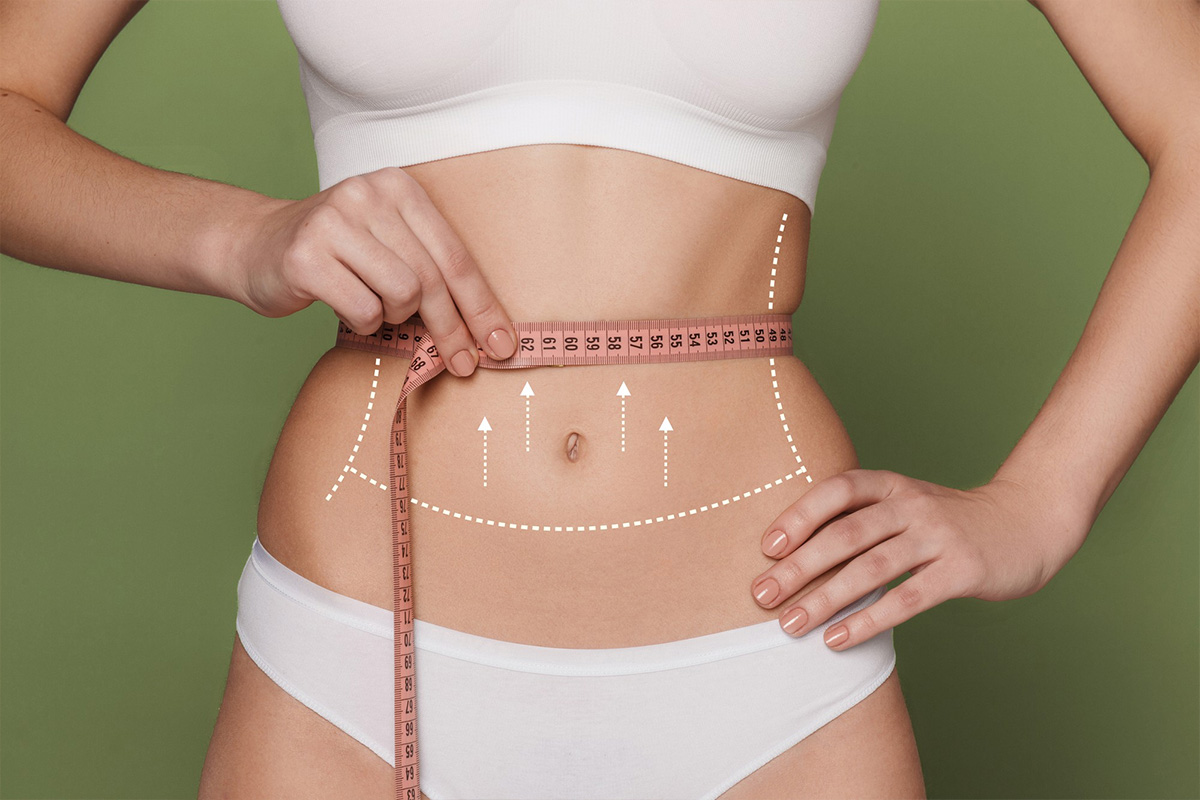 Liposuction of the hips and waist | Liposuction of the hips and waist